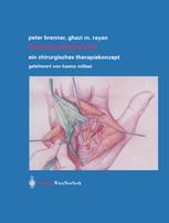 Prof. Dr. Peter Brenner, Dr. Ghazi M. Rayan (auth.) — Morbus Dupuytren: Ein chirurgisches Therapiekonzept