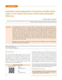 Nuraldeen Maher Al-Khanati — Immediate autotransplantation of immature maxillary third molar: A case report with 4‐year clinical and radiographic follow‐up