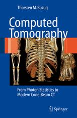 Thorsten Buzug Prof. Dr. (auth.) — Computed Tomography: From Photon Statistics to Modern Cone-Beam CT