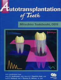 Mitsuhiro Tsukiboshi — Autotransplantation of Teeth