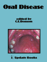 David S. Berman (auth.), C. E. Renson Ph.D, BDS, DDPH, LDSRCS (eds.) — Oral Disease