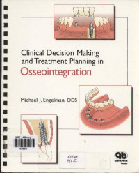 Engelman M.J. — Clinical Decision Making and Treathment Planning in Osseointigration