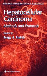 Valery Usatoff, Nagy A. Habib (auth.), Nagy A. Habib (eds.) — Hepatocellular Carcinoma: Methods and Protocols