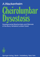 Auguste Wackenheim (auth.) — Cheirolumbar Dysostosis: Developmental Brachycheiry and Stenosis of the Bony Vertebral Lumbar Canal