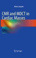 Alexis Jacquier (auth.) — CMR and MDCT in Cardiac Masses: From Acquisition Protocols to Diagnosis