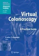 Joseph T. Ferrucci MD (auth.), Philippe Lefere MD, Stefaan Gryspeerdt MD (eds.) — Virtual Colonoscopy: A Practical Guide