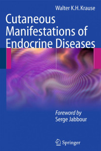 Em. Prof. Dr. med. Walter K. H. Krause (auth.) — Cutaneous Manifestations of Endocrine Diseases