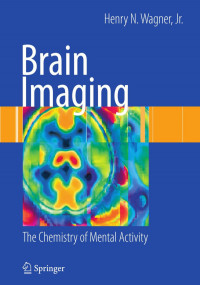 Henry N. Wagner Jr. (auth.) — Brain Imaging: The Chemistry of Mental Activity