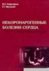 Коваленко В.Н., Несукай Е.Г. — Некоронарогенные болезни сердца