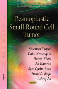 Nausheen Yaqoob; Dalal Nemenqani; Hatem Khoja; Ali Kamran; Syed Qasim Raza; Fuoad Al dayel; Ashraf Ali — Desmoplastic Small Round Cell Tumor