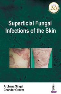 Archana Singal; Chander Grover — Superficial Fungal Infections of the Skin