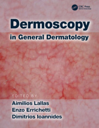 Errichetti, Enzo;Ioannides, Dimitrios;Lallas, Aimilios — Dermoscopy in general dermatology