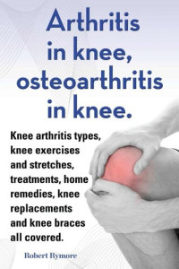 Robert Rymore — Arthritis in knee, osteoarthritis in knee. Knee arthritis exercises and stretches, treatments, home remedies, knee replacements and knee braces all covered.