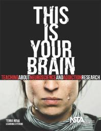 Terra Nova Learning Systems — This Is Your Brain : Teaching about Neuroscience and Addiction Research