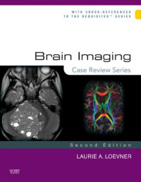 Laurie A. Loevner MD — Brain Imaging: Case Review Series