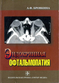Бровкина А.Ф. — Эндокринная офтальмопатия