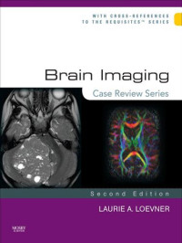 Laurie A. Loevner — Brain Imaging: Case Review Series (Case Review)