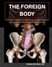Andrew Del Gaizo M.D — The Foreign Body: A collection of the most interesting X-rays of things that don't belong and the stories behind how they got there!