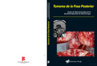 Sociedad Española de Neurocirugía — Tumores de la Fosa Posterior