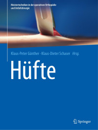 Klaus-Dieter Schaser, Klaus-Peter Günther, (Hrsg.) — Hüfte