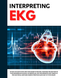 Mann, Katherine — Interpreting EKG: EKG Interpretation For Nurses | EKG Interpretation Practice | EKG Interpretation Book