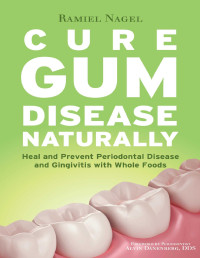 Nagel, Ramiel — Cure Gum Disease Naturally: Heal and Prevent Periodontal Disease and Gingivitis with Whole Foods