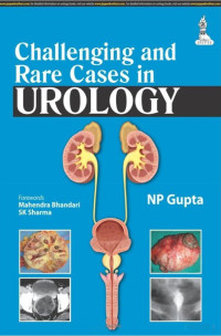 NP Gupta — Challenging and Rare Cases in Urology