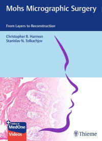 Christopher B. Harmon, Stanislav N. Tolkachjov — Mohs Micrographic Surgery: From Layers to Reconstruction