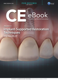 Gregg Helvey, DDS, CDT — Implant Supported Restoration Techniques