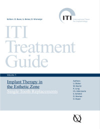 U. Belser / W. Martin / R. Jung / C. Hämmerle / B. Schmid / D. Morton / D. Buser — ITI Treatment Guide 1