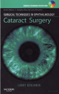 Larry Benjamin — Cataract Surgery