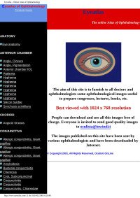 Unknown — Eyeatlas - Online Atlas of Ophthalmology
