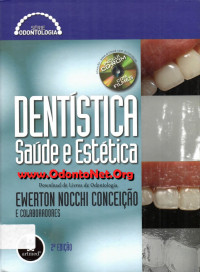 Ewerton Nocchi Conceição — Dentística Saúde e Estética