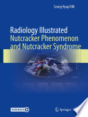 Seung Hyup Kim — Radiology Illustrated: Nutcracker Phenomenon and Nutcracker Syndrome