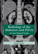 SWATI. GOYAL — Radiology of the Abdomen and Pelvis - A Case-Based Guide (Sep 30, 2024)_(1032588780)_(CRC Press).pdf