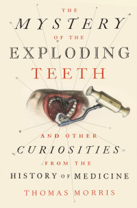 Thomas Morris — The Mystery of the Exploding Teeth: And Other Curiosities from the History of Medicine