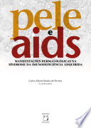 Carlos Alberto Basilio de Oliveira — Pele e Aids