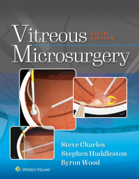 Steve Charles;Stephen Huddleston;Byron Wood; & Stephen Huddleston, MD & Byron Wood, BA — Vitreous Microsurgery