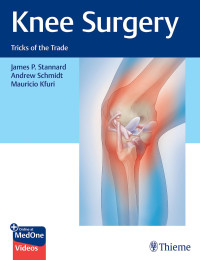 James Stannard, Andrew Schmidt, Mauricio Kfuri — Knee Surgery