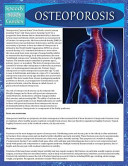 Speedy Publishing LLC,  — Osteoporosis (Speedy Study Guide)