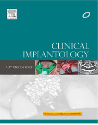 AJAY VIKRAM SINGH — Clinical Implantology