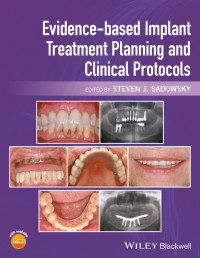 Steven J. Sadowsky — Evidence-based Implant Treatment Planning and Clinical Protocols