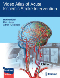 Mokin, Maxim & Elad I. Levy & Adnan H. Siddiqui — Video Atlas of Acute Ischemic Stroke Intervention