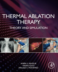 Amira S. Ashour, Yanhui Guo, Waleed S. Mohamed — Thermal Ablation Therapy