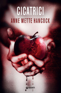 Anne Mette Hancock — Cicatrici