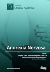 Stephan Zipfel, Andreas Stengel, Katrin Giel — Anorexia Nervosa
