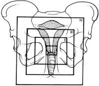 Unknown — The Johns Hopkins Manual of Gynecology and Obstetrics 3ed