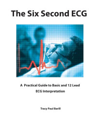 Tracy Paul Barill — Six Second ECG eBook