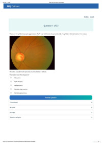 BMJ OnExamination — BMJ OnExamination Assessment MRCP II OPHTHALMOLOGY