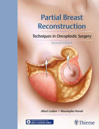 Albert Losken, Moustapha Hamdi — Partial Breast Reconstruction : Techniques in Oncoplastic Surgery